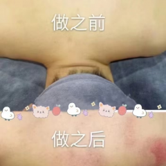 按摩/肩颈背部腰部